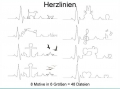 EKG Herzlinien 10x10 13x18 16x26